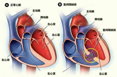 全国心脏科医院排名，守护心脏健康的权威之选